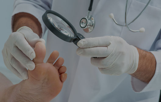 What is a Bunion?